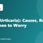 Hives (Urticaria): Causes, Relief and When to Worry