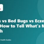 Scabies vs Bed Bugs vs Eczema vs Hives: How to Tell What’s Making You Itch